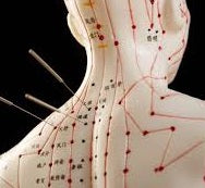 Acupuncture instruments针灸器具- Chinses Medicine | TCMshops